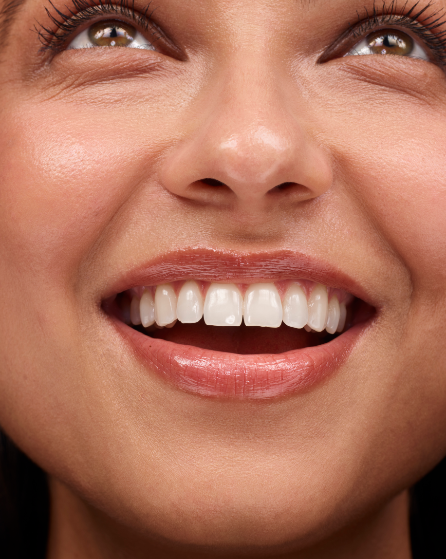 Ultralip · Labial bálsamo