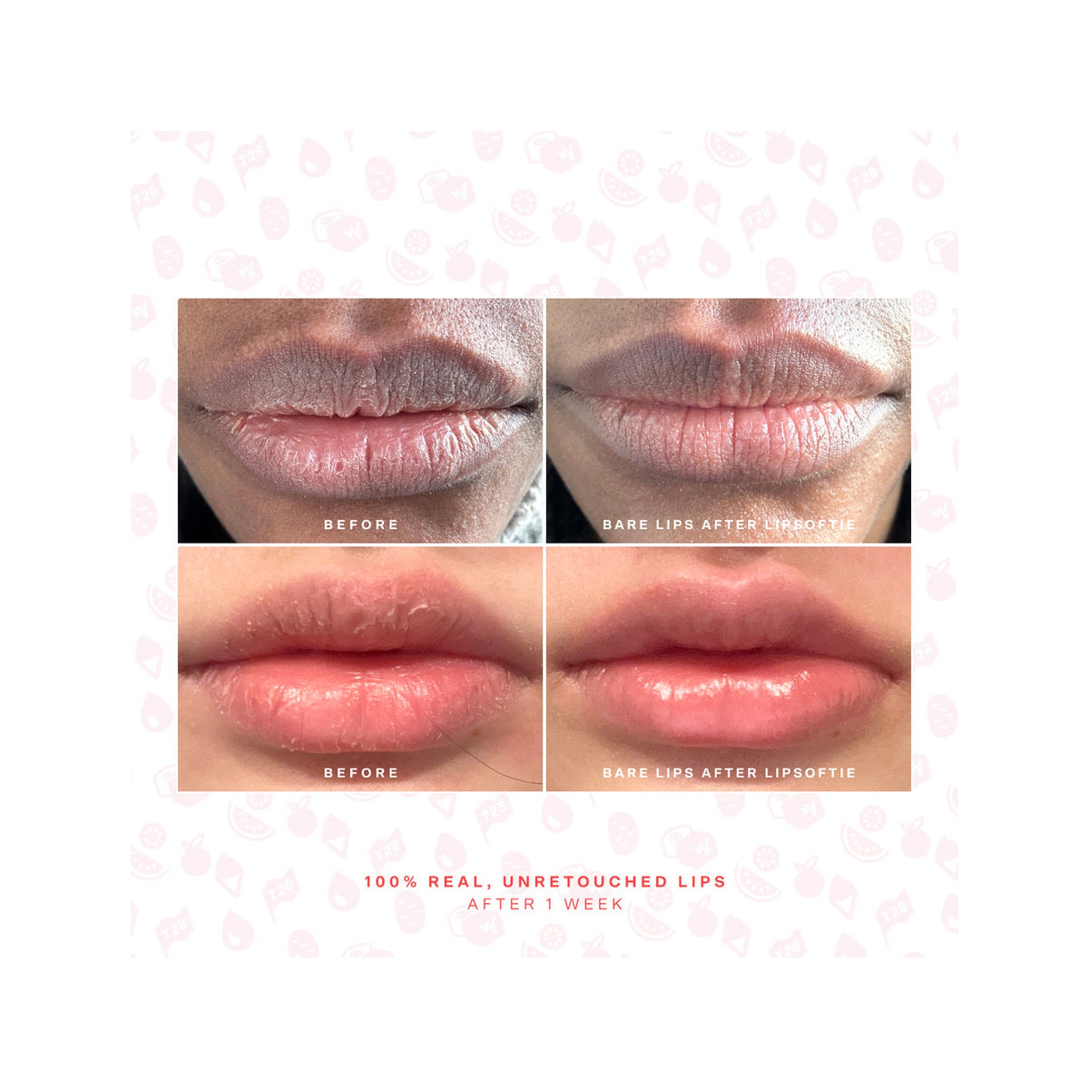 SOS LipSoftie · Tratamiento labial intensivo