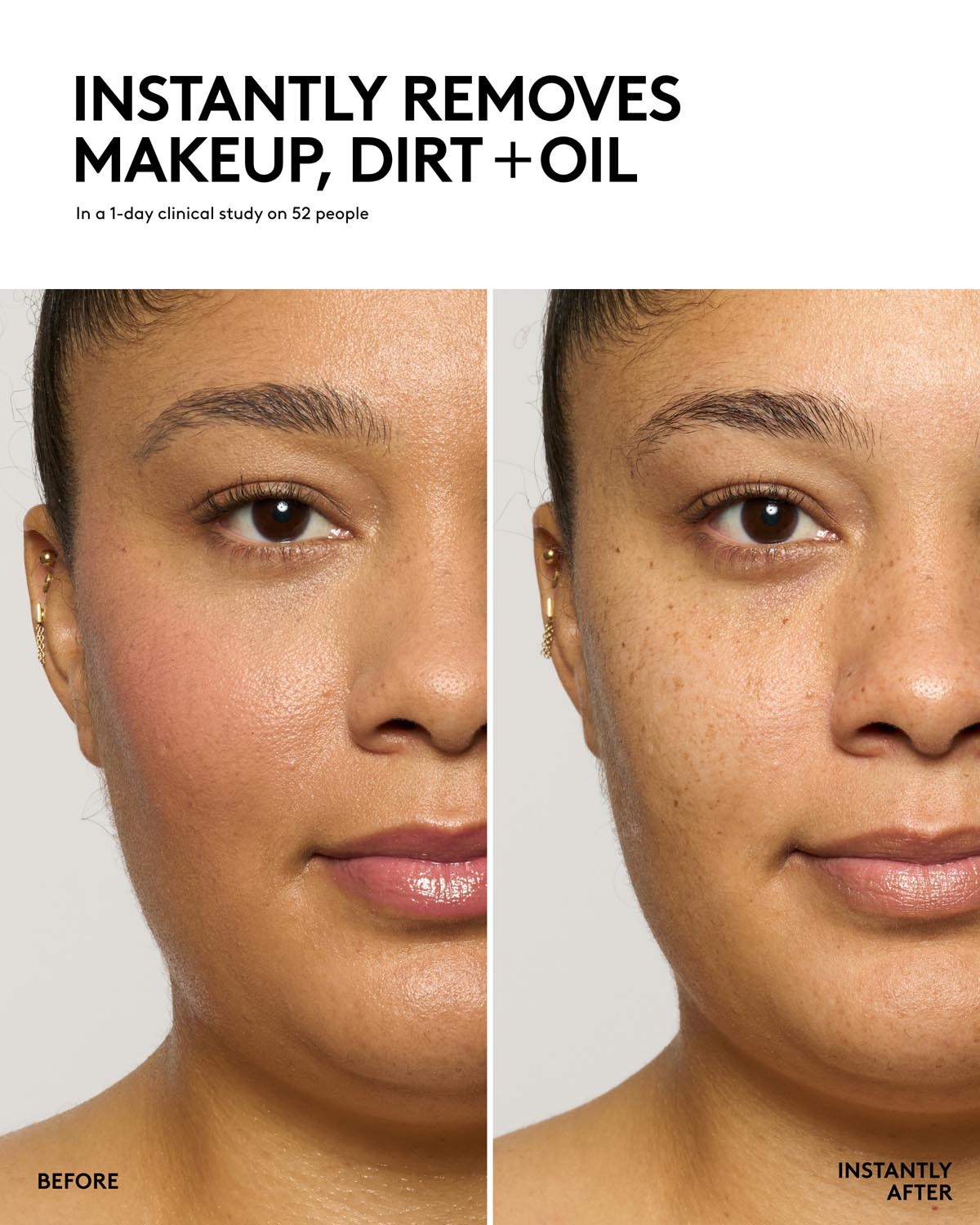 Total Cleans'r · Limpiador facial