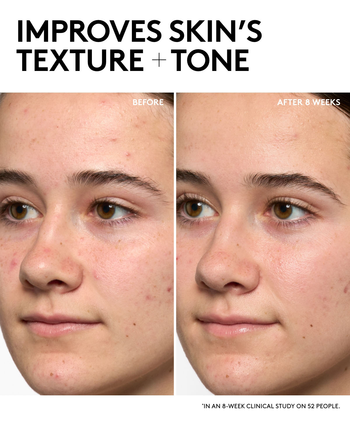 Hydra Vizor · Hidratante invisible SPF 30