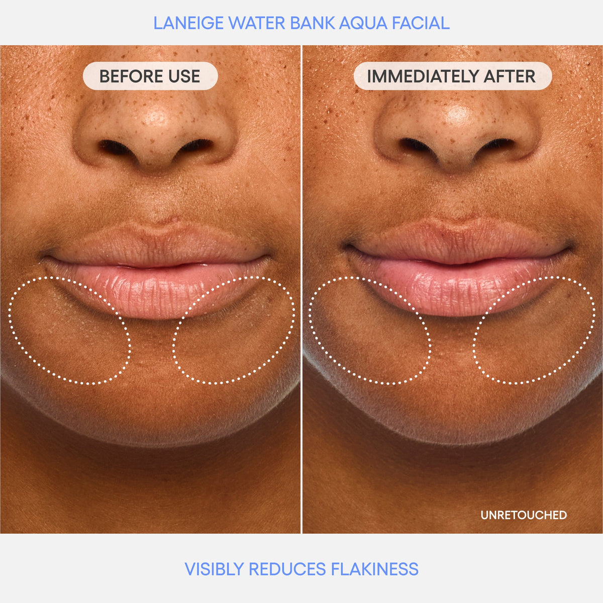 Water Bank Aqua Facial · Sérum exfoliante
