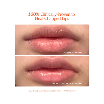 LipSoftie · Tratamiento labial